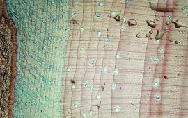 The photo shows growth rings under the microscope