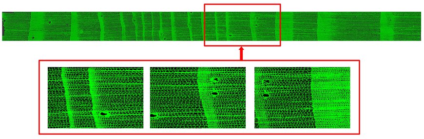 Digitale Erfassung der Zellstrukturen mithilfe der Konfokalen Laser Scanner Mikroskopie.